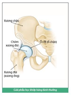 hình ảnh khớp háng