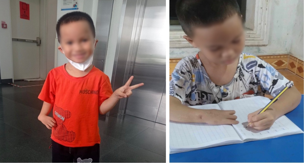 Minh Dat’s right hand (left photo) before and after the surgery (right hand). He can straighten his hand now.