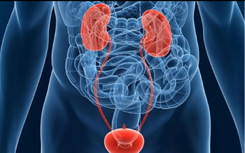 Bladder cancer can cause a lot of pain for patients if not treated early.