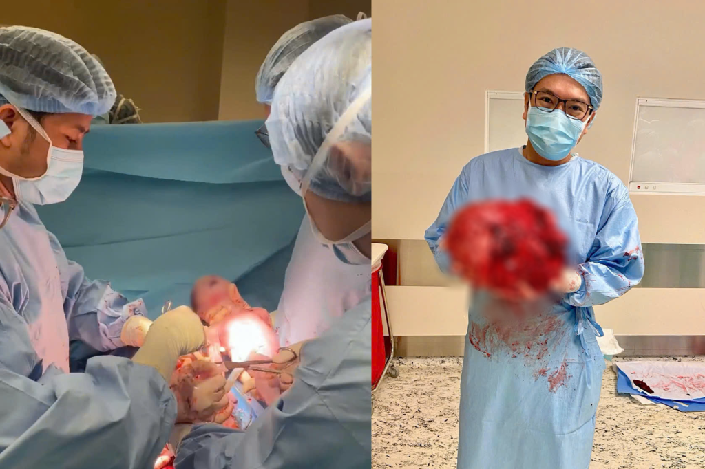 Dr Vo Trieu Dat safely performed a caesarean section and removed an 8 kg fibroid for the Cambodian mother.