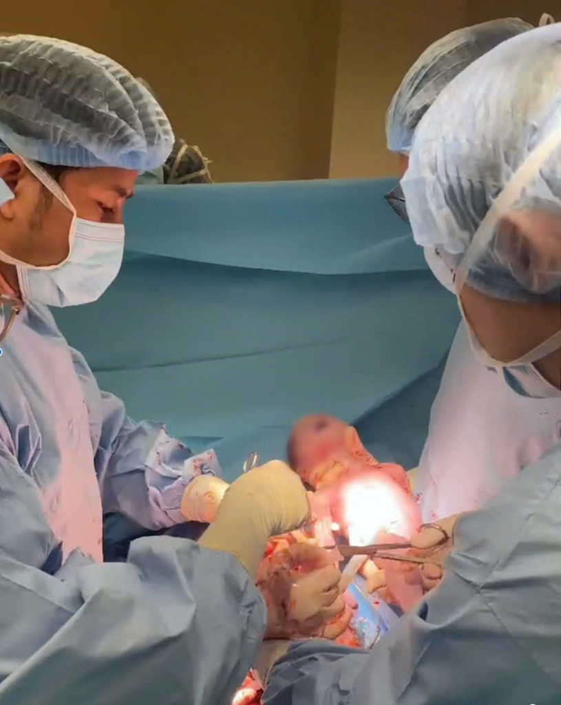 The moment when the FV medical team successfully delivered the baby from the mother’s womb.