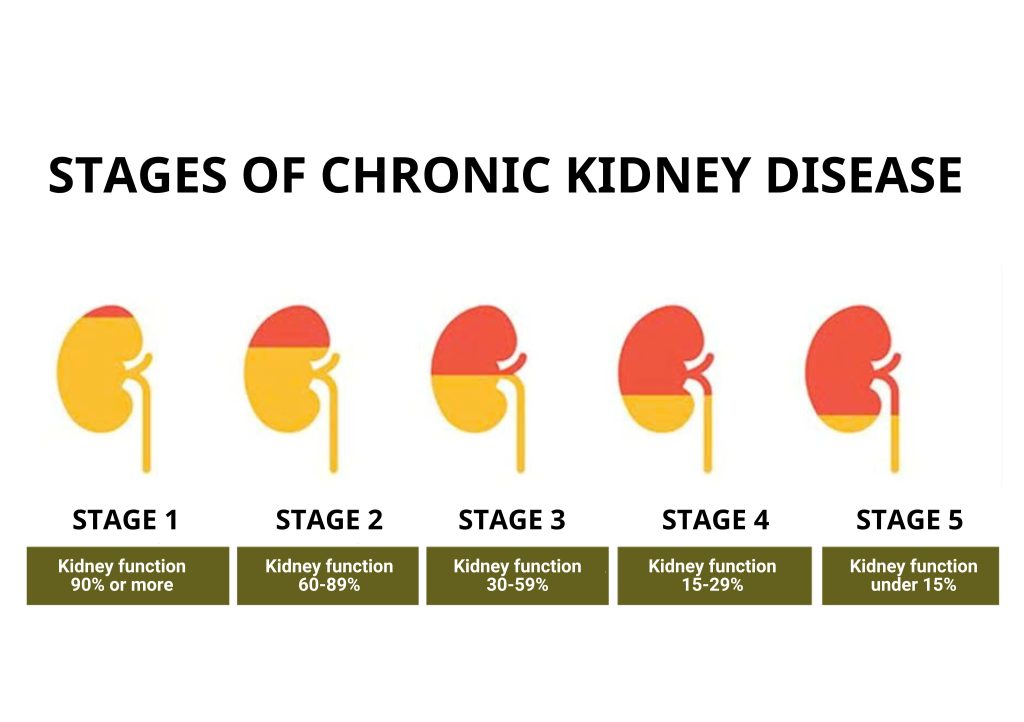 The 5 Stages of Chronic Kidney Disease (CKD)