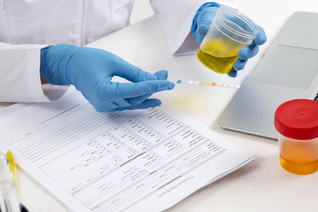 Microalbumin Urine Test to Assess Risk of Kidney Failure Due to Diabetes