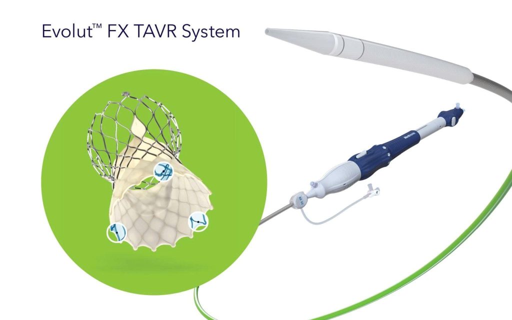 Diagram of the Evolut™ FX Aortic Valve Implantation System through Catheter (TAVI).