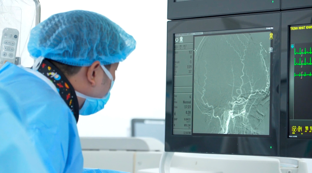 Imaging of cerebral blood vessels surrounding the tumour during embolisation