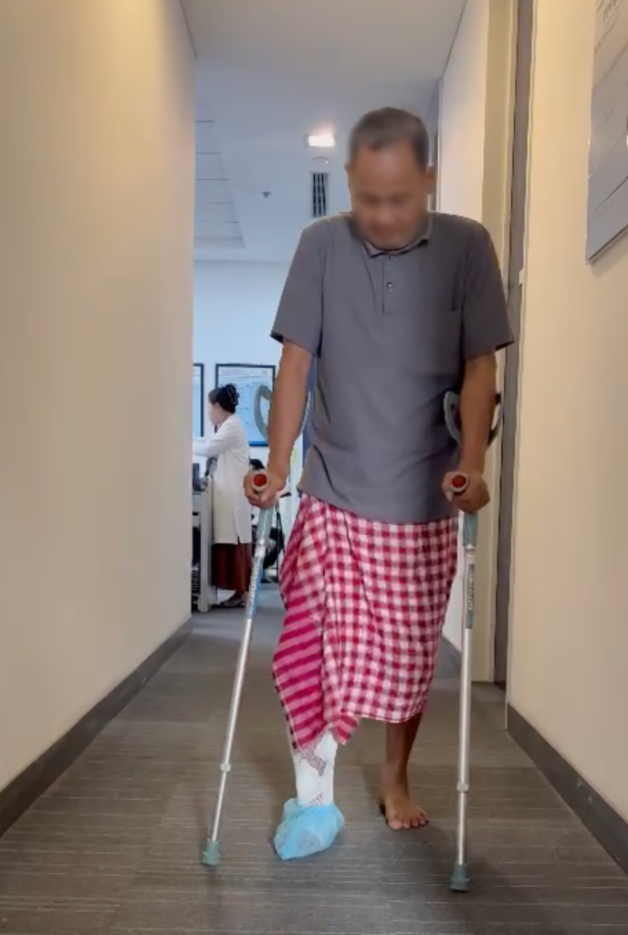 Patient Pov Saroeun walking again after seven surgeries.